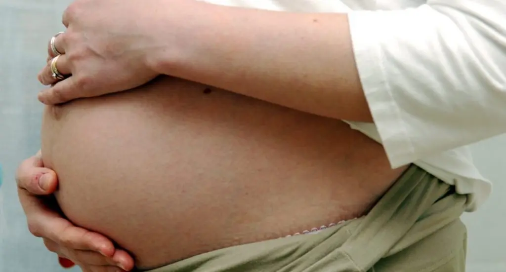 Femme enceinte